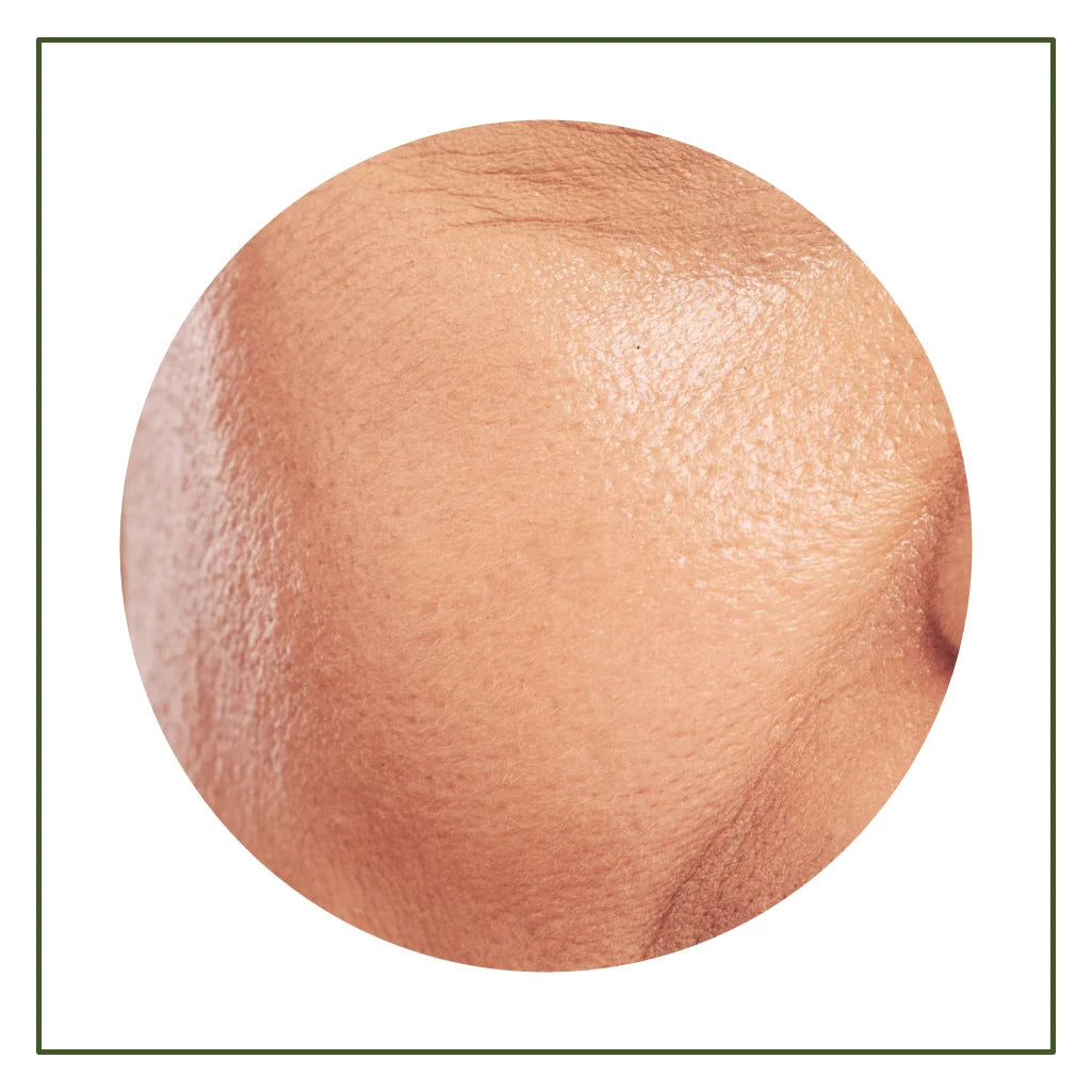 Ageing & Fine Lines